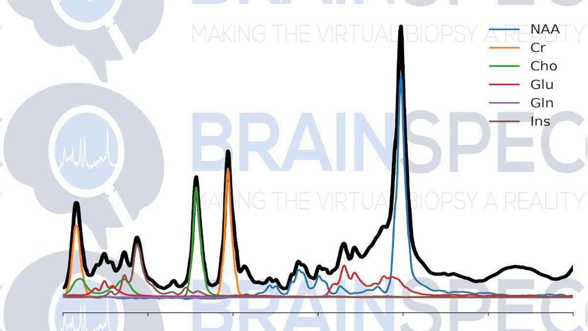 Brain_Spec's tweet image. 🌟🔎 Tailoring #MS treatments with BrainSpec Core™ by monitoring metabolic changes – a step towards personalized healthcare. #MultipleSclerosis #Innovation