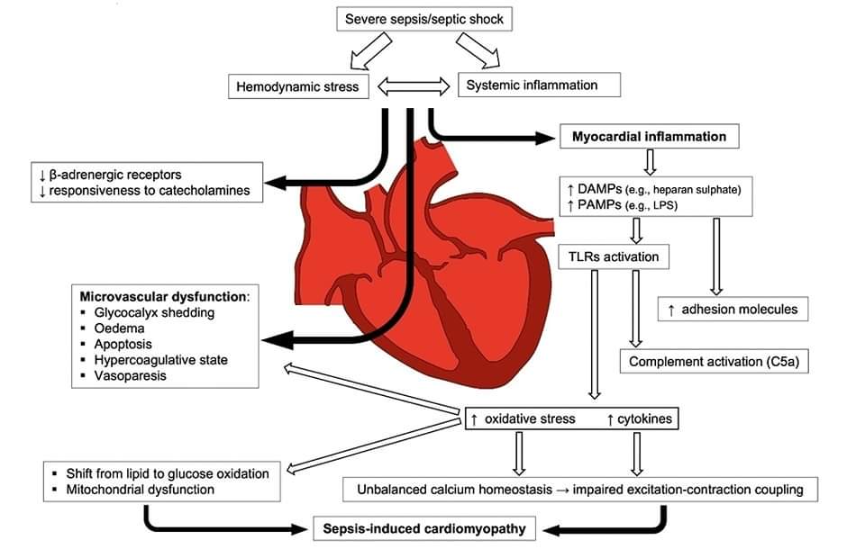 LeslieMegom's tweet photo. 🫀Miocardiopatía por sepsis :
 💠30-50% de los pacientes sépticos tienen una fracción de eyección <45%;
 💠 Volumen sistólico  normal o bajo;
 💠Biomarcadores cardíacos elevados (troponina, NT-BNP): pronóstico de mal resultado
 💠Eco: generalmente disfunción global.
Hilo👇🧵 https://t.co/fcu3JmZ6Bm