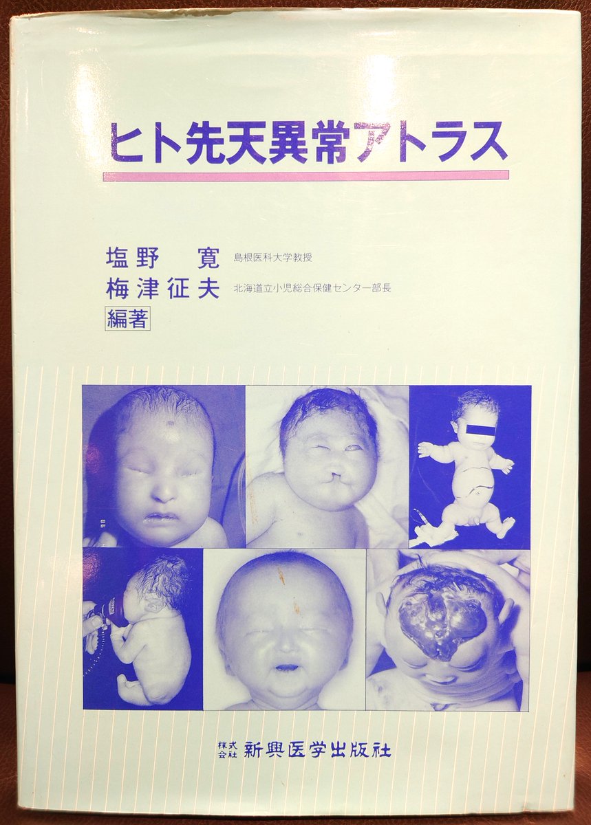 新先天奇形症候群アトラス 改訂第２版 100812_s.jpg