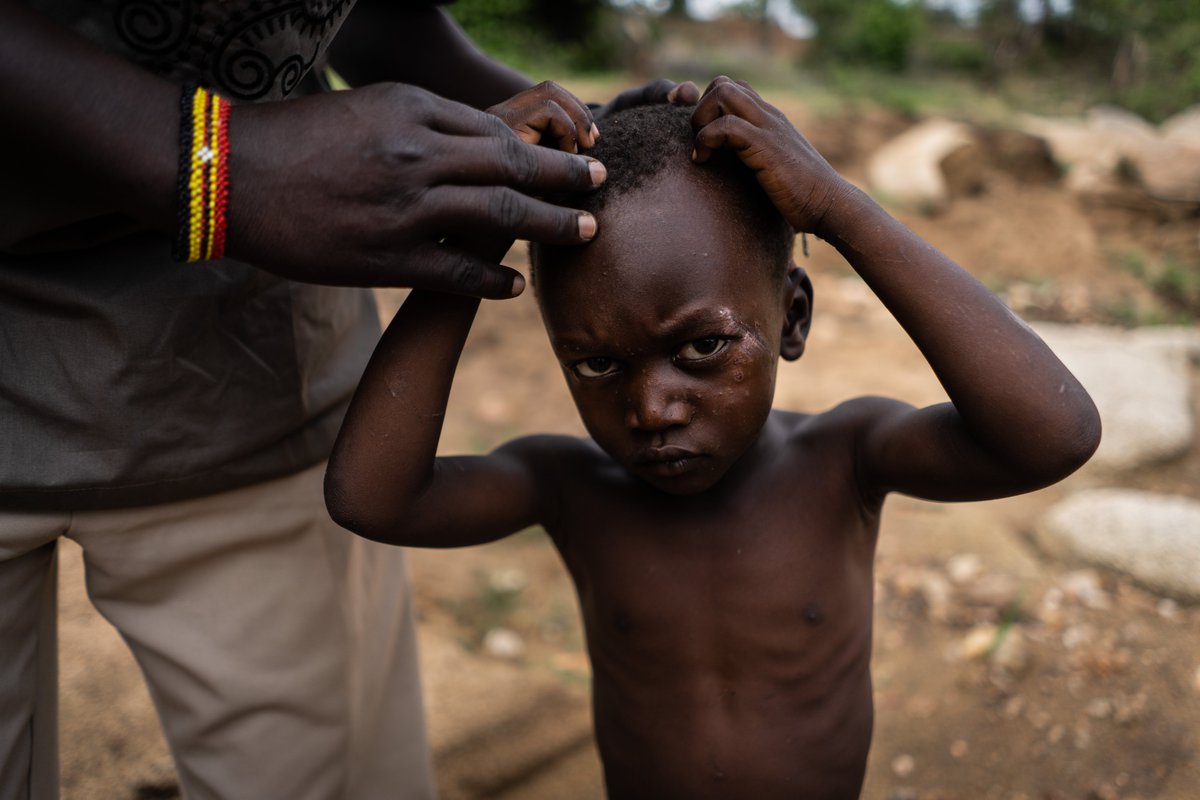 PUBLICATION <a href="/Reporterre/">Reporterre 🌍 | Le média de l'écologie</a> 📷
Le changement climatique accélère la ruée vers l’or en Ouganda. L’extraction a remplacé les activités pastorales. Mais le recours au mercure, extrêmement polluant, empoisonne l’eau et contamine les habitants. Avec <a href="/LucieMouillaud/">Lucie Mouillaud</a>
reporterre.net/Eau-polluee-en…