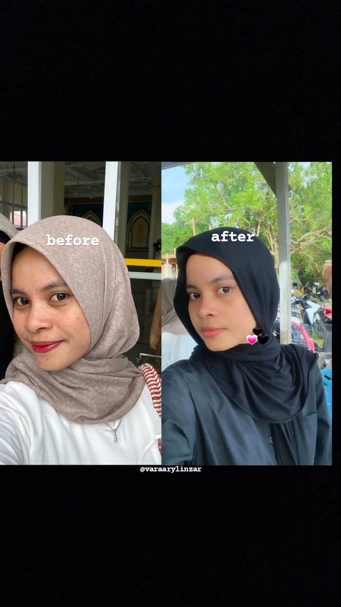 varaarylinzar's tweet photo. Mau rekomendasiin teamwork diwajahku 😍
Yang punya masalah dengan jerawat, bruntusan, komedo, sama tekstur kulit enggak merata.
Please ini bagus banget ✨️
P.M.S series dari Adara #PMSnowWorries #ProtectMySkin #racuninskincare https://t.co/L1DFc7ZIqm