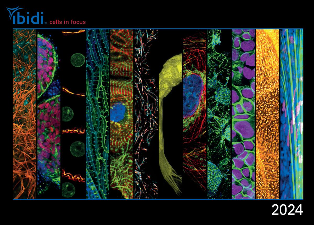 ibidiCells's tweet photo. 🔬😍Brace yourselves for a visual feast! Our 2024 Calendar is here📆.
A big shout-out to all the brilliant minds behind these captivating images 👩🔬👨🔬
#Caleder #Photocontest #bioart #calender2024 #microscopyimages #scienceandart #sciart #scienceinfocus #imaging #scienceisfun https://t.co/by1BncdXK2