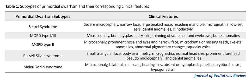 @studyrare Seckel syndrome,is characterized by microcephaly, proportionate dwarfism of prenatal onset, and a typical “bird-headed” profile (beaked nose, receding forehead, prominent eyes and micrognathia).