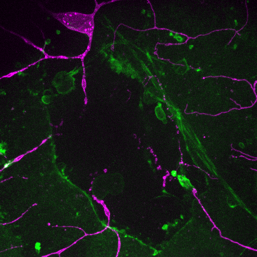 tri_lab_AJ's tweet photo. 🔬Welcome to TRIscope Insights!  Let's explore the amazing world of microscopy! 🔬

The image depicts a wound on the epidermis of a fruit fly 🪰, highlighting the epithelial wound edge and the resulting impact on the dendrites of a sensory neuron. https://t.co/zhx208GbuB