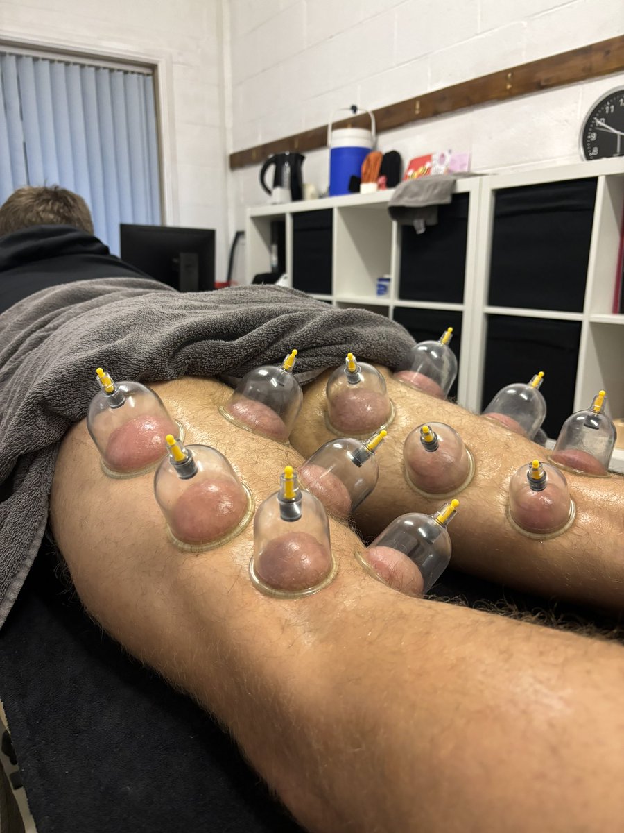 MPriestnerGSR's tweet photo. 🤲 | #CuppingTherapy with @bailey_dawes10 at Priestner Injury Clinic session on Monday down at @EltonValeFC https://t.co/pYjfwULEBv