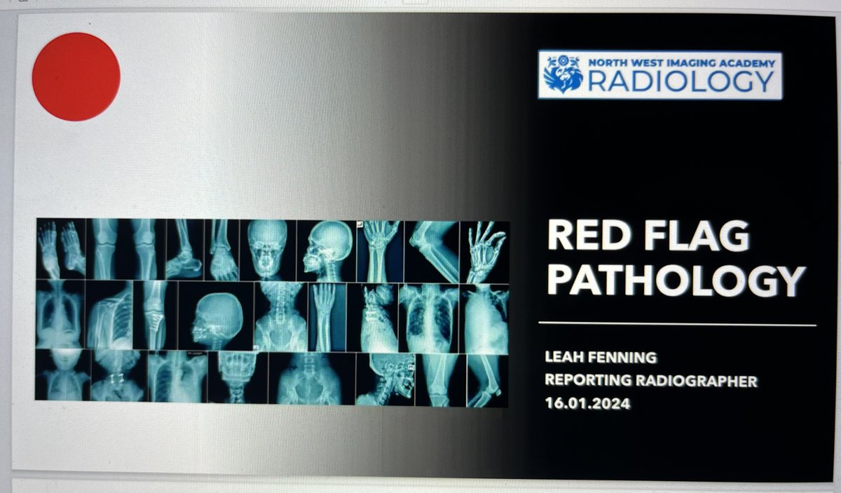 A really interesting session this evening by <a href="/leahfenning/">Leah Fenning</a> <a href="/LauraDKellyRad/">Laura Kelly</a> <a href="/SalfordUni/">University of Salford</a> on pathology in plain film imaging.
