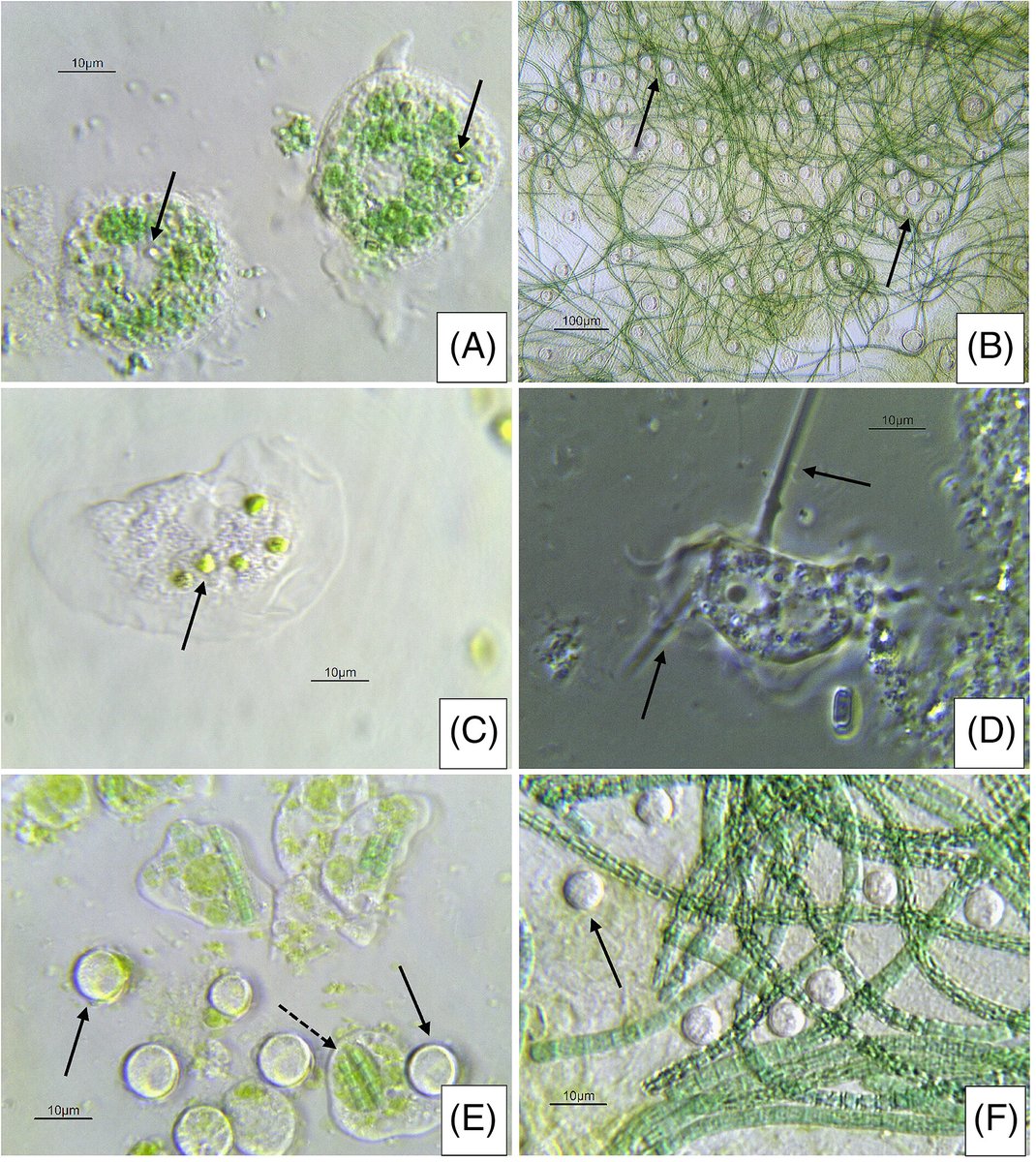 JEukMicro's tweet photo. Grazing preferences of three species of #amoebae on cyanobacteria and green algae | Harold G. Weger et al. https://t.co/dY7CdWBS0M https://t.co/Gn5TsD8v0F