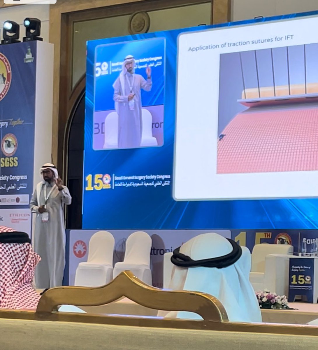 zaaad's tweet photo. It was a great pleasure to meet and share the stage with fellow hernia enthusiast surgeons and experts at the #sgss2024 in Jeddah. Thank you @AshrafMaghraby @OhoudAlamoudi4 @AlalawiYousef for the exceptional congress. 
@SGSS_KSA 
https://t.co/K0QWRoDMHg https://t.co/k2qZMvalj7