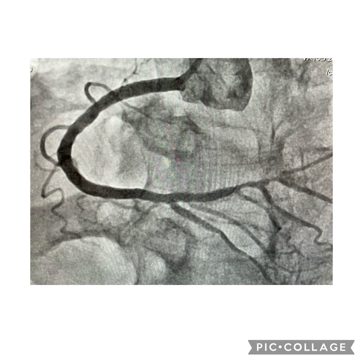 André Manica, MD PhD tweet media