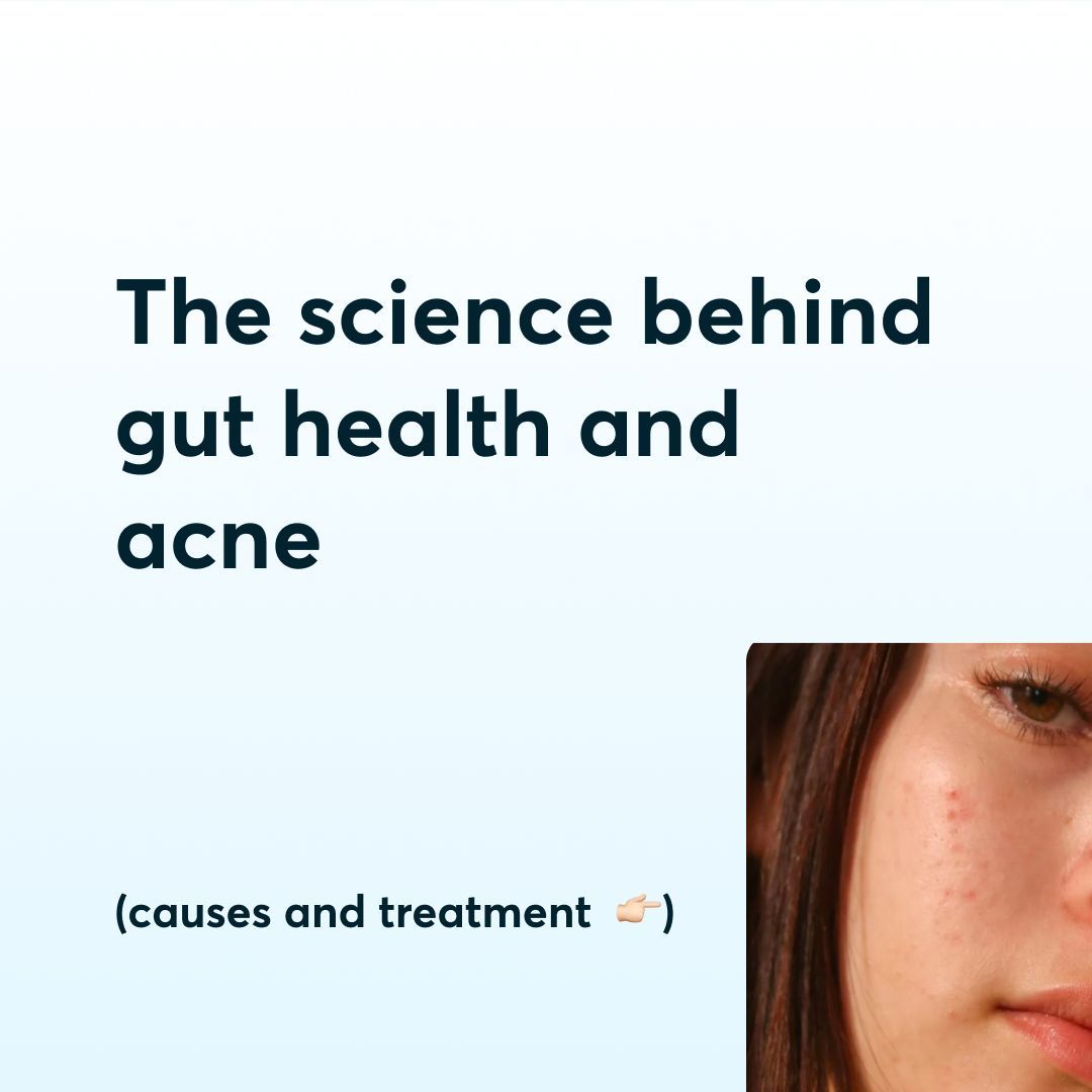 MDacne's tweet photo. The link between gut and skin health is a fascinating area of research, and it offers valuable insights for managing acne and promoting overall skin well-being. Probiotics show promise in supporting gut microbiome, which may help reduce inflammation and improve acne symptoms. https://t.co/tjmm39ryDd