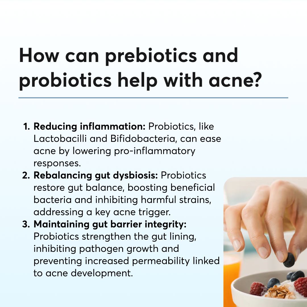 The link between gut and skin health is a fascinating area of research, and it offers valuable insights for managing acne and promoting overall skin well-being. Probiotics show promise in supporting gut microbiome, which may help reduce inflammation and improve acne symptoms.