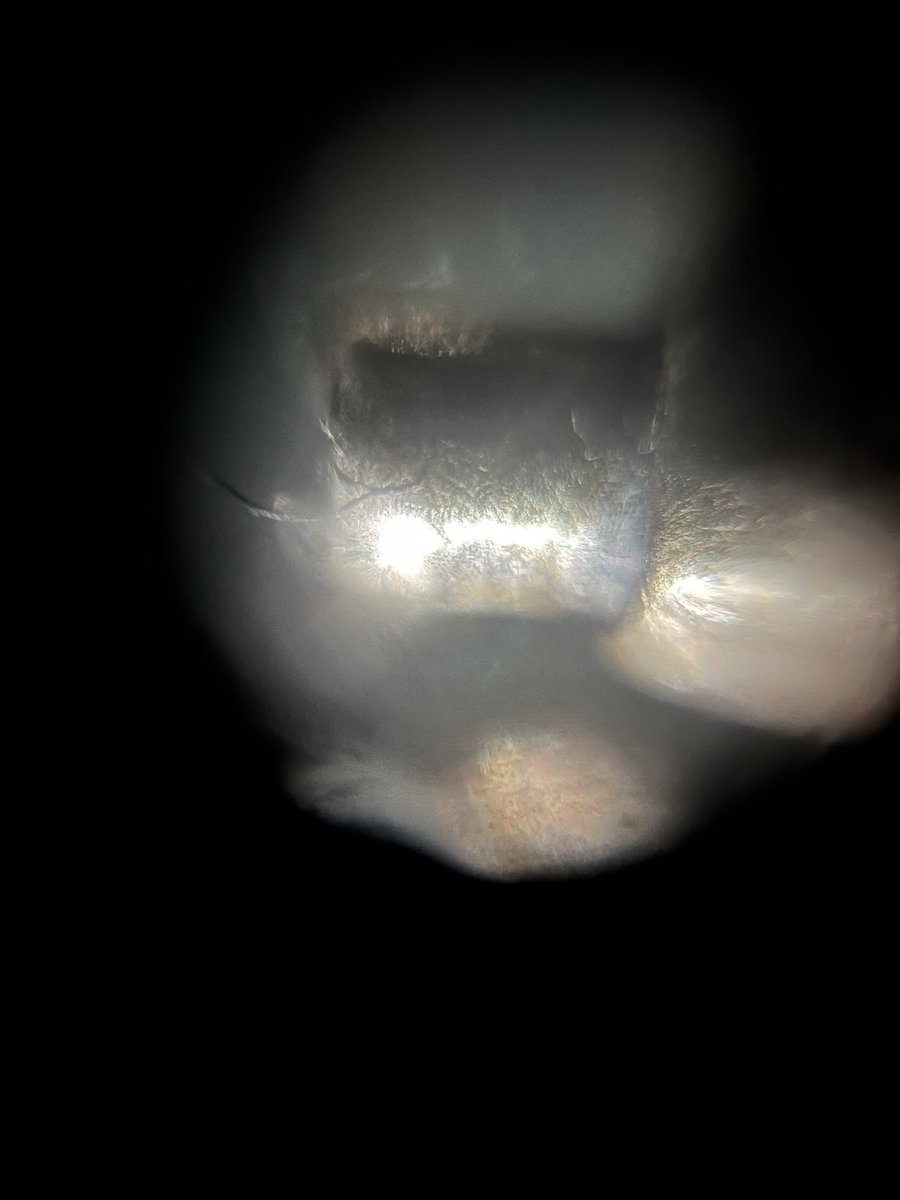 hollyastuart's tweet photo. A microscope lens viewed through a microscope lens?
I put my @BoutiqAcademia microscope necklace under my #Foldscope 2.0. I especially love the aesthetic from the chain pictures!
50X magnification w/ reflective lighting
#Connections #STEAM #ScienceIsBeautiful #ScienceInArt https://t.co/TZlteCKJPw