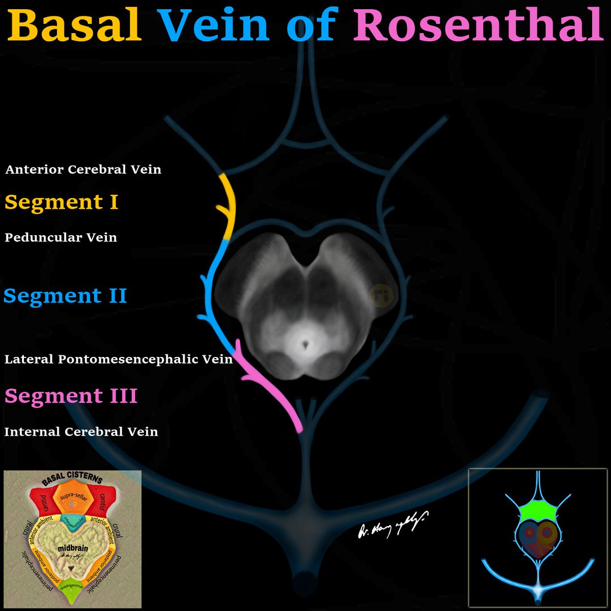 drharunyildiz's tweet photo. Basal Venous Circle (Trolard Circle) 

#radiologicalillustration ✍️
pixel by pixel handmade! https://t.co/oaa1QufU5u