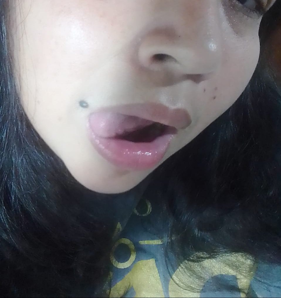 putit