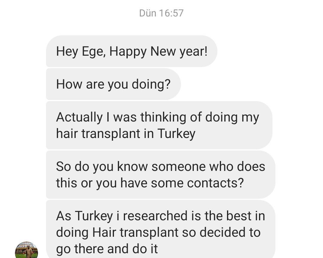 egeulucay's tweet photo. 2024 update geldi https://t.co/54JL5d6dDC