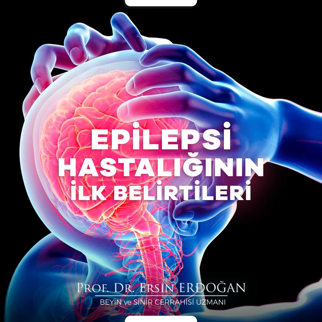 beyincerrahisi's tweet photo. ➜ Epilepsi, beyinde bulunan bir grup nöronda gerçekleşen anormal elektrik aktivitesine bağlı oluşur. Kişinin nöbet geçirmesine yol açan bu durum süresince beyin fonksiyonları geçici olarak bozulur. https://t.co/7bjnQdCrFD