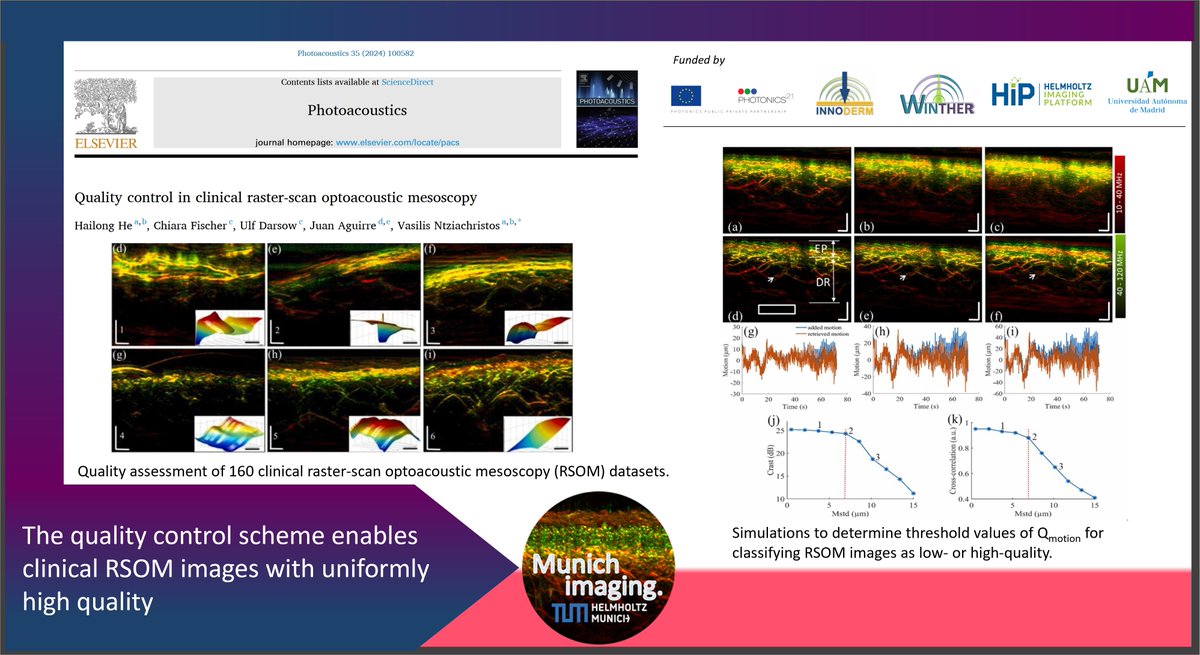 MunichImaging's tweet photo. As images may be affected by #motion and noise, we introduce a quality control scheme enabling the #standardization of Raster-Scan #Optoacoustic Mesoscopy #RSOM images for #clinical and #biomedical applications.
Read @ElsevierPhysics #Photoacoustics
https://t.co/vTyzwcuR9g https://t.co/LaRnlNp37A