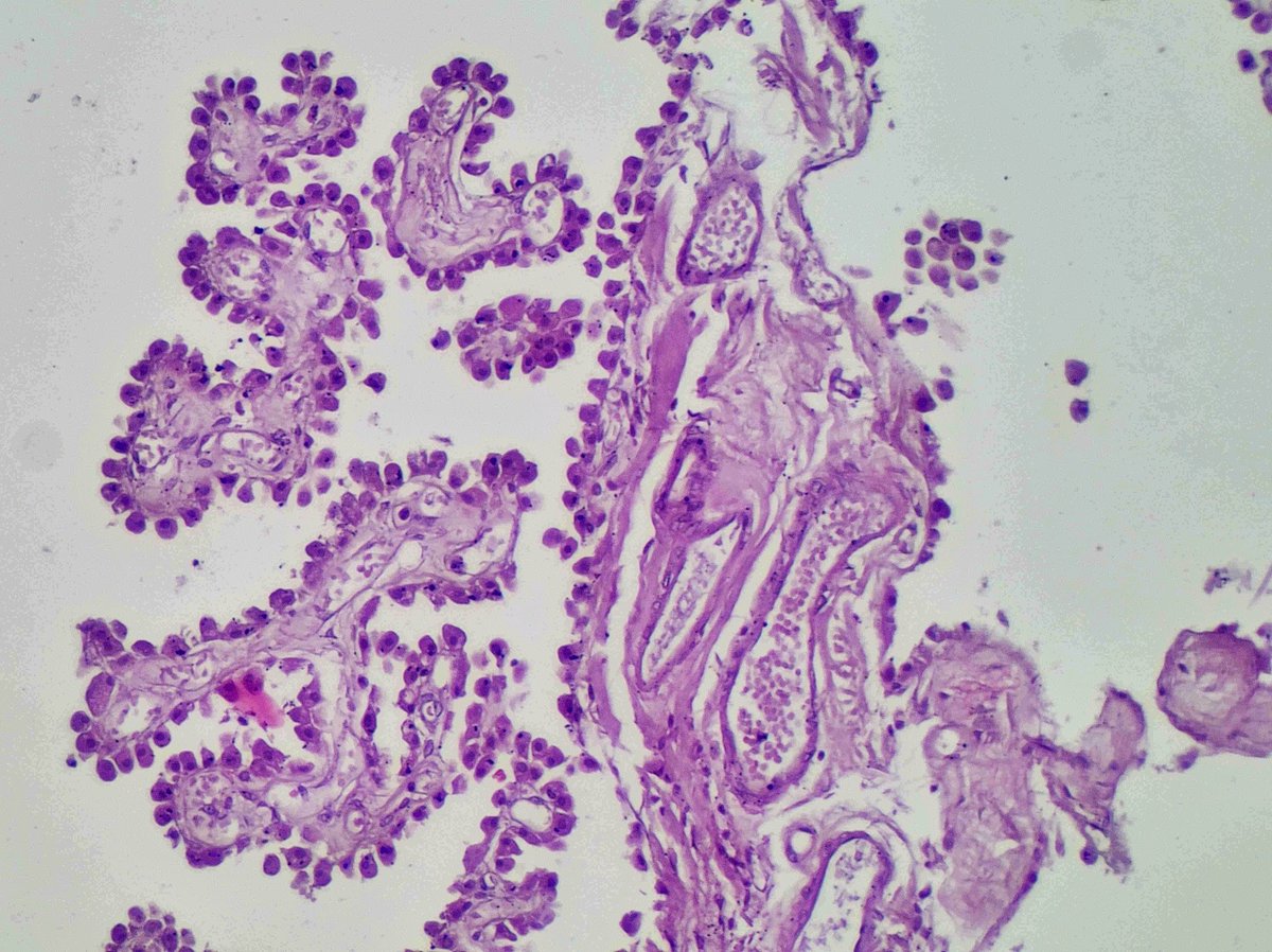 Drmerm's tweet photo. 😍😍😍
#BeautifulPath #pathtwitter #neuropath https://t.co/r6XUKEPPkJ