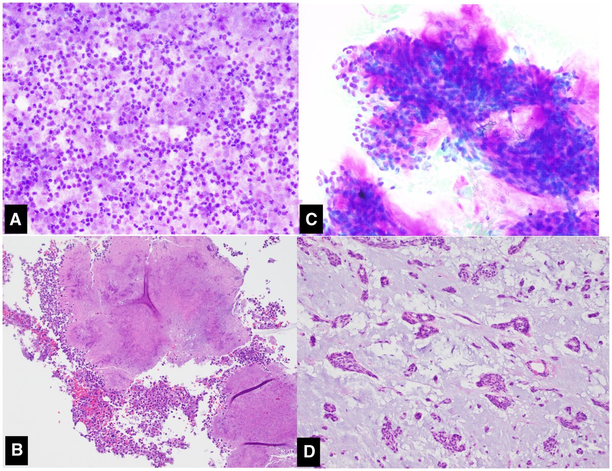 Cancer Cytopathology tweet media