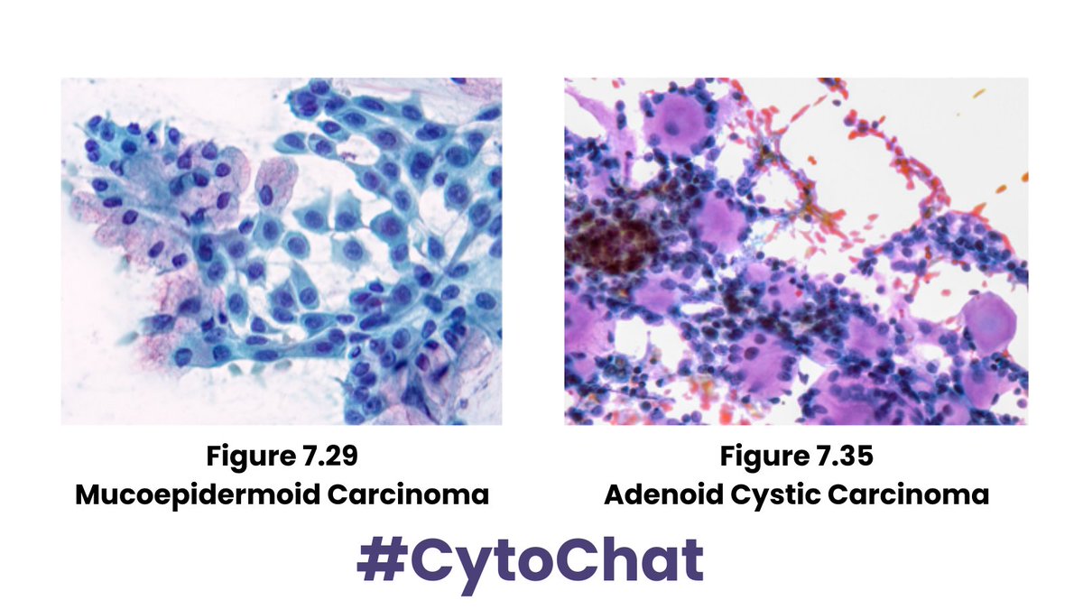 Cancer Cytopathology tweet media