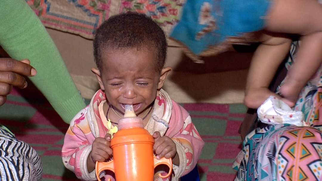 #UPDATE FROM #TIGRAY😢

A child who has not tasted her mother's breast
  
Child Liya Mesfen is a child who suffers from various problems, she was born in a lock and suffered from drought and hunger. She does not know her mother's breast. Why?
#TigrayHungerCrisis #TigrayFamine 
1/