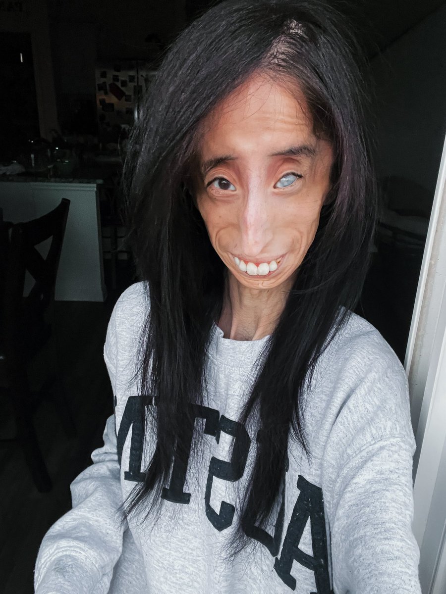 Lizzie Velasquez tweet media