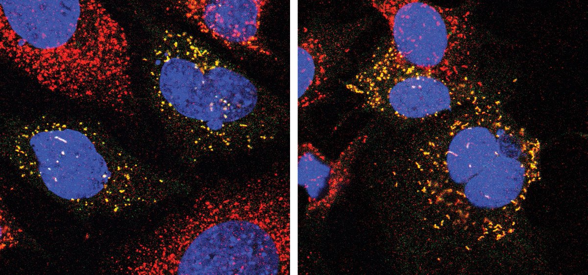 Optimizing how cells recycle waste ♻️ could improve outcomes for patients with neurodegenerative conditions.

Read how this #SKResearch genetically increased cellular recycling with hopes of improving care for people with Zellweger Spectrum Disorder ➡  bit.ly/3TTm8Pb