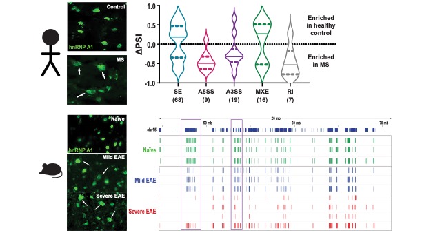 SKMSOffice's tweet photo. Check out our latest #research showing hnRNP A1 dysfunction alters RNA splicing and drives neurodegeneration in MS, published with @SpringerNature in @NatureComms! Read it here: https://t.co/mwgkgu57jC https://t.co/hm3xuJWMso
