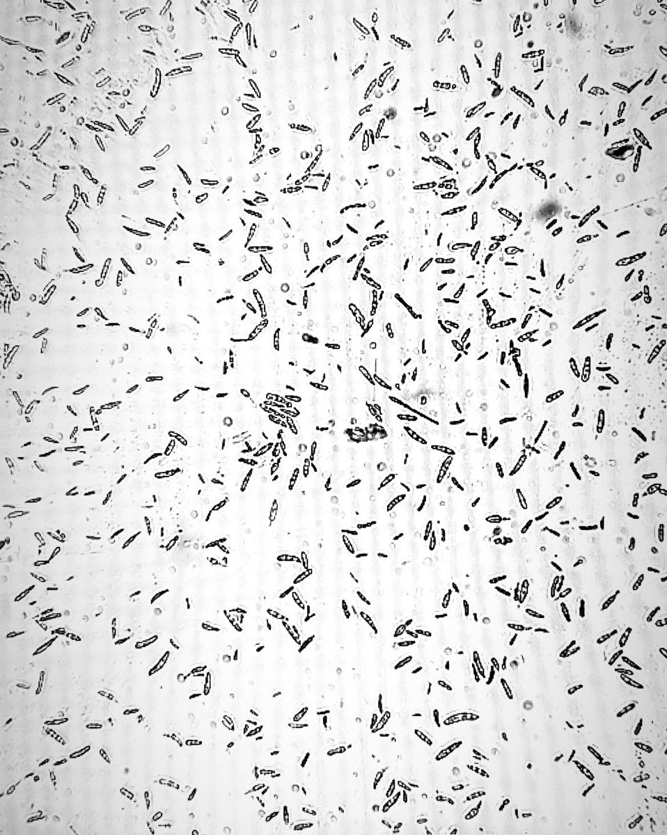 NBotlagunta's tweet photo. I was stuck with Fusarium oxysporum f.sp. Cucumarinum spore production for my research work (plant microbiome engineering). I tried multiple methods but failed. Many thanks to Dr. Remco stam @EvoMPMI methodology https://t.co/RWxuhwCY7U. I got millions of spores in first attempt. https://t.co/LO5fwqvWj9
