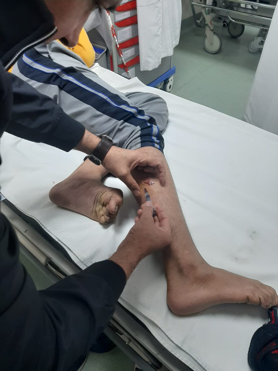 ravibhadoria's tweet photo. ग्रेटर नोएडा वेस्ट की हिमालय प्राइड सोसायटी में आवारा कुत्ते ने एक बच्चे को बुरी तरह काटा। निवासियों का कहना है कुत्ता प्रेमी गैंग के लोग सोसायटी में खाना खिलाने के बहाने आवारा कुत्तों को ले आये हैं।
बच्चे बूढ़े दहशत में हैं, नीचे पार्क में कुत्ते खेलते हैं। ग्रेटर नोएडा वेस्ट की लगभग हर सोसायटी में अब आवारा कुत्तों की भरमार होती जा रही है, एक दिन अवश्य क���त्ता प्रेमी गैंग और निवासी सड़कों पर भिड़ेंगे यदि इस समस्या और गैंग के आतंक का निराकरण नहीं हुआ तो। @OfficialGNIDA