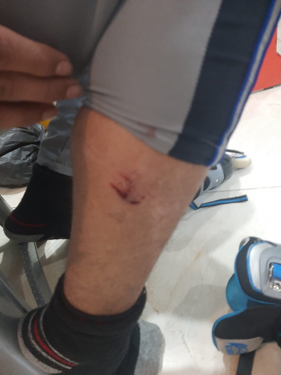 ravibhadoria's tweet photo. ग्रेटर नोएडा वेस्ट की हिमालय प्राइड सोसायटी में आवारा कुत्ते ने एक बच्चे को बुरी तरह काटा। निवासियों का कहना है कुत्ता प्रेमी गैंग के लोग सोसायटी में खाना खिलाने के बहाने आवारा कुत्तों को ले आये हैं।
बच्चे बूढ़े दहशत में हैं, नीचे पार्क में कुत्ते खेलते हैं। ग्रेटर नोएडा वेस्ट की लगभग हर सोसायटी में अब आवारा कुत्तों की भरमार होती जा रही है, एक दिन अवश्य क���त्ता प्रेमी गैंग और निवासी सड़कों पर भिड़ेंगे यदि इस समस्या और गैंग के आतंक का निराकरण नहीं हुआ तो। @OfficialGNIDA