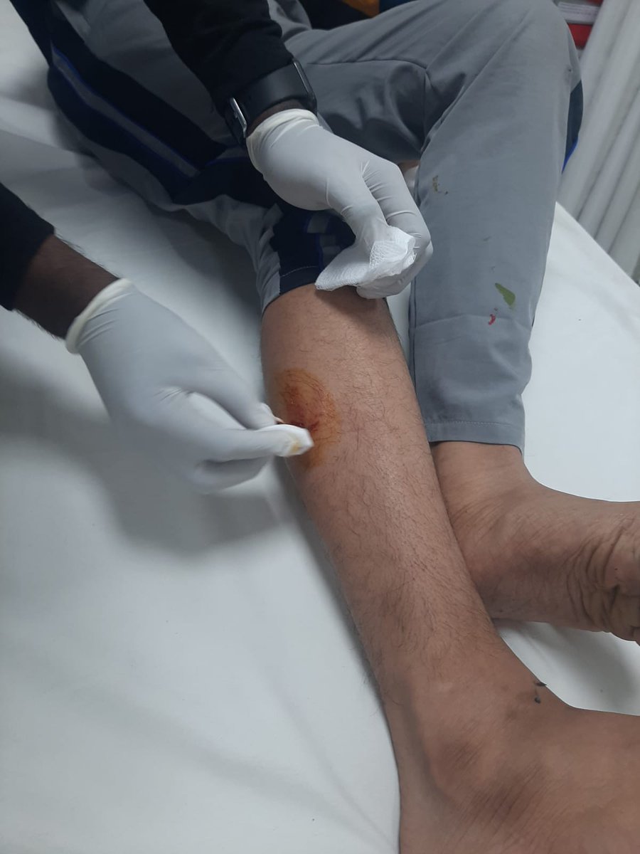 ravibhadoria's tweet photo. ग्रेटर नोएडा वेस्ट की हिमालय प्राइड सोसायटी में आवारा कुत्ते ने एक बच्चे को बुरी तरह काटा। निवासियों का कहना है कुत्ता प्रेमी गैंग के लोग सोसायटी में खाना खिलाने के बहाने आवारा कुत्तों को ले आये हैं।
बच्चे बूढ़े दहशत में हैं, नीचे पार्क में कुत्ते खेलते हैं। ग्रेटर नोएडा वेस्ट की लगभग हर सोसायटी में अब आवारा कुत्तों की भरमार होती जा रही है, एक दिन अवश्य क���त्ता प्रेमी गैंग और निवासी सड़कों पर भिड़ेंगे यदि इस समस्या और गैंग के आतंक का निराकरण नहीं हुआ तो। @OfficialGNIDA