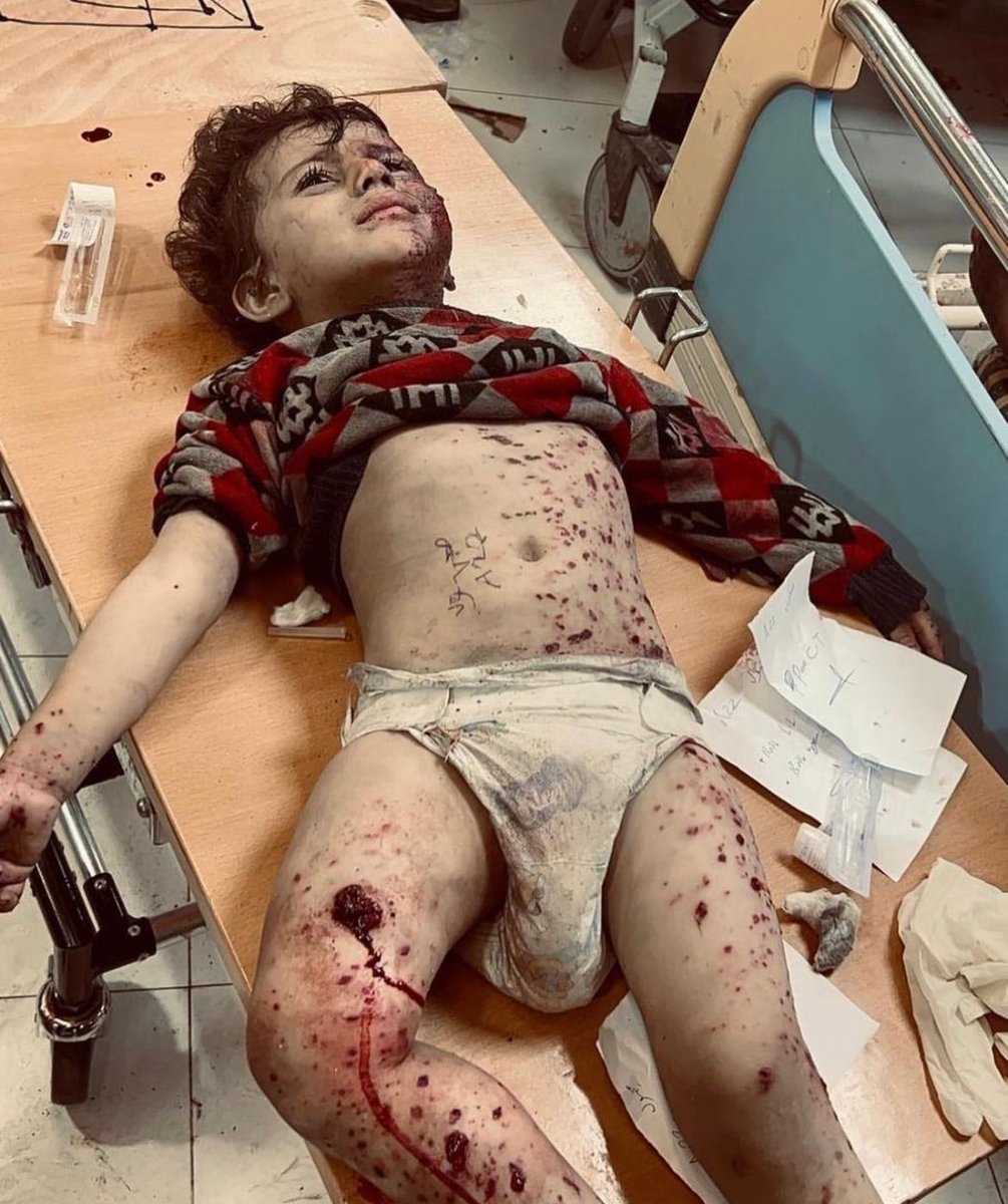 SSsfwNN's tweet photo. @lujeinmv @MMuizzu Don't look away!
This is what American weapons do to the children of Gaza. Over 12,000 children killed by Israel in three months, more than 20,000 children injured, over a thousand children have lost their limbs, and more than 25,000 children are now orphans. #GazaGenocide https://t.co/ZtSEUUMlbG