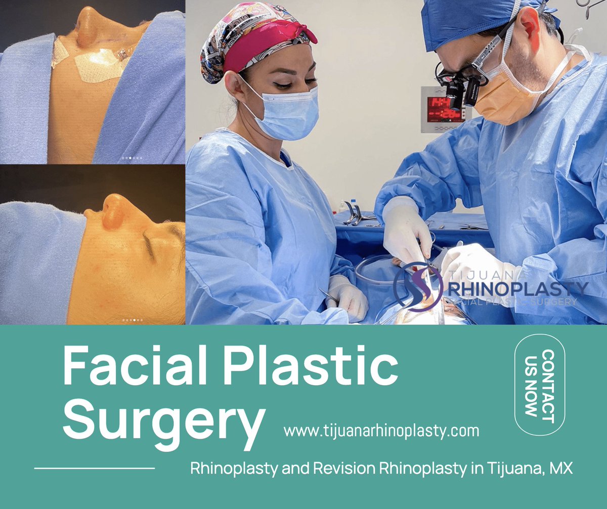 strictlyfaces's tweet photo. Improve your Self Esteem with a Rhinoplasty
https://t.co/1xDZIUa79P
Dr. Edgar E Santos is a board certified Facial Plastic Surgeon in Tijuana, Mexico. He specializes in rhinoplasty surgery and revision rhinoplasty.
#plasticsurgery #rhinoplasty #nosejob #Tijuana https://t.co/ufuBZh3osV
