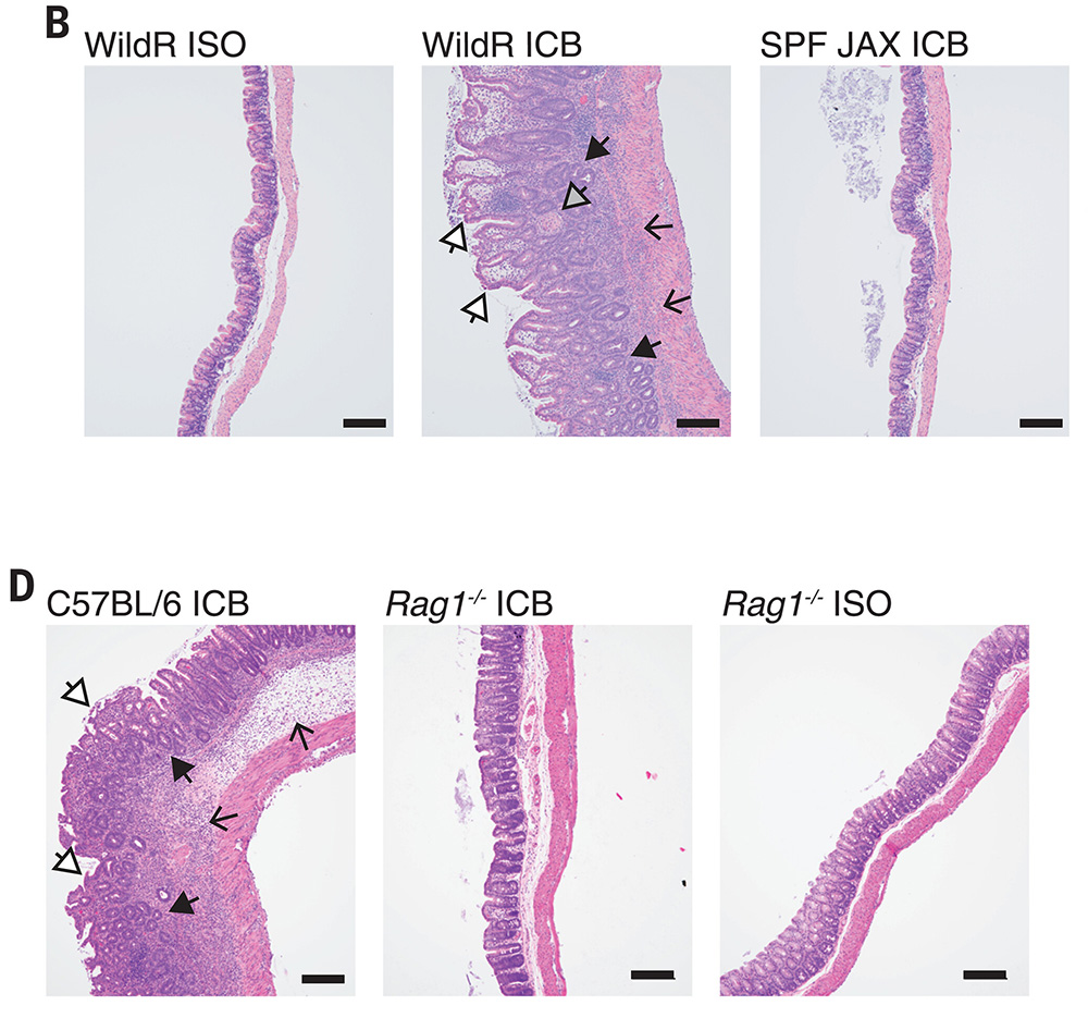 ScienceMagazine's tweet photo. Anti-CTLA-4 nanobodies promote antitumor immunity without inducing colitis in mice, a new Science study finds. 

The results could advance the development of CTLA-4 inhibitors that promote antitumor immune responses without triggering intestinal disease. https://t.co/VJq0o3Yq2O https://t.co/Olbx3PufAF