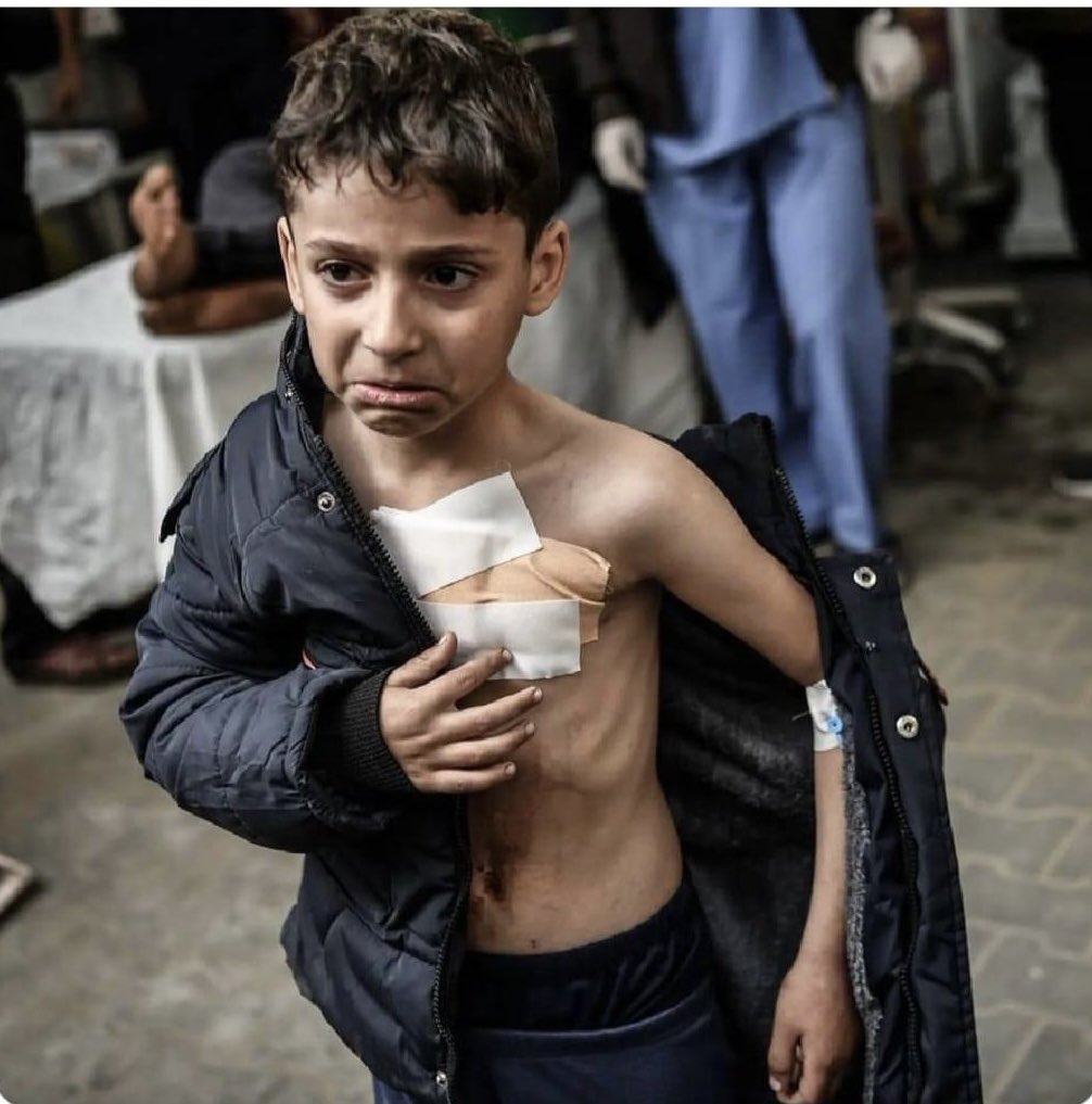 This photo today is from Gaza. Look at his body. You can see his skeleton. The starvation of the people of Gaza is happening before the eyes of the world... Imagine if this was your son or daughter!!!