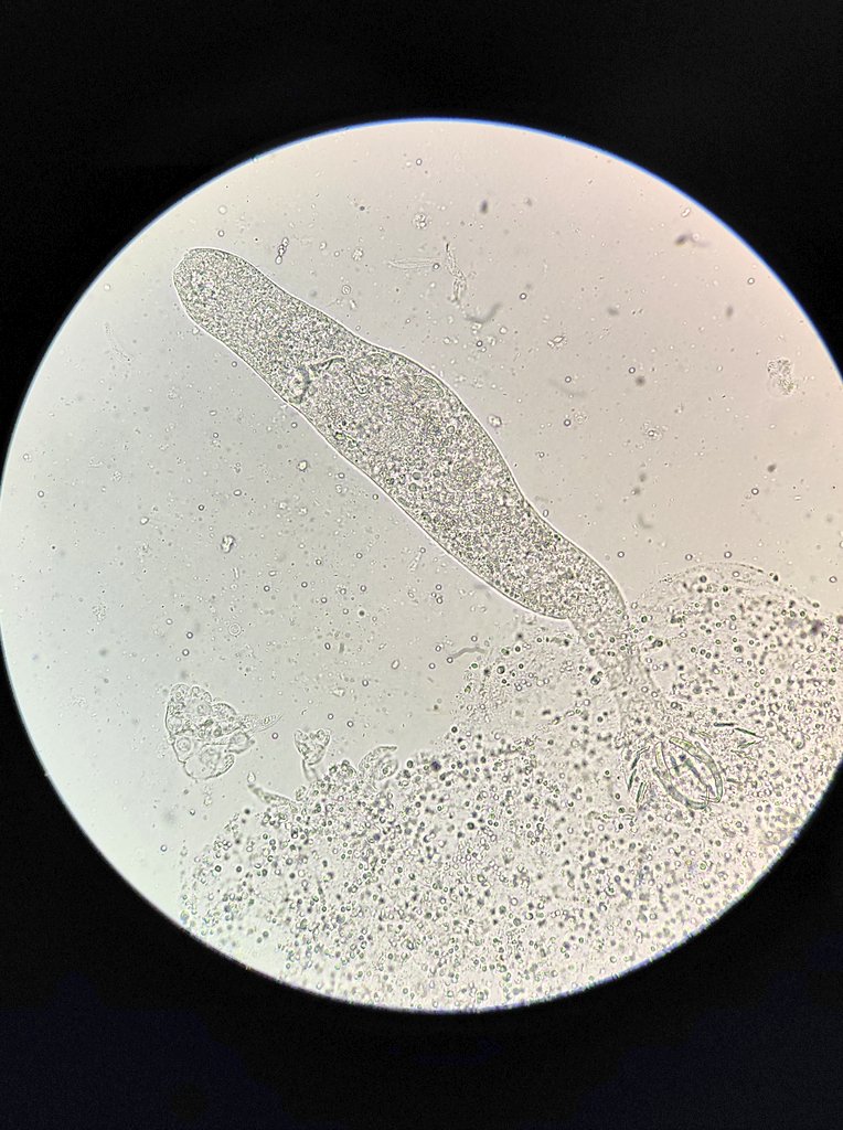 Nitin34396837's tweet photo. Monogenea found from the Gills of Indian Major Carp 🐟 #parasitology #fish #monogenea https://t.co/FcIQfmigAM