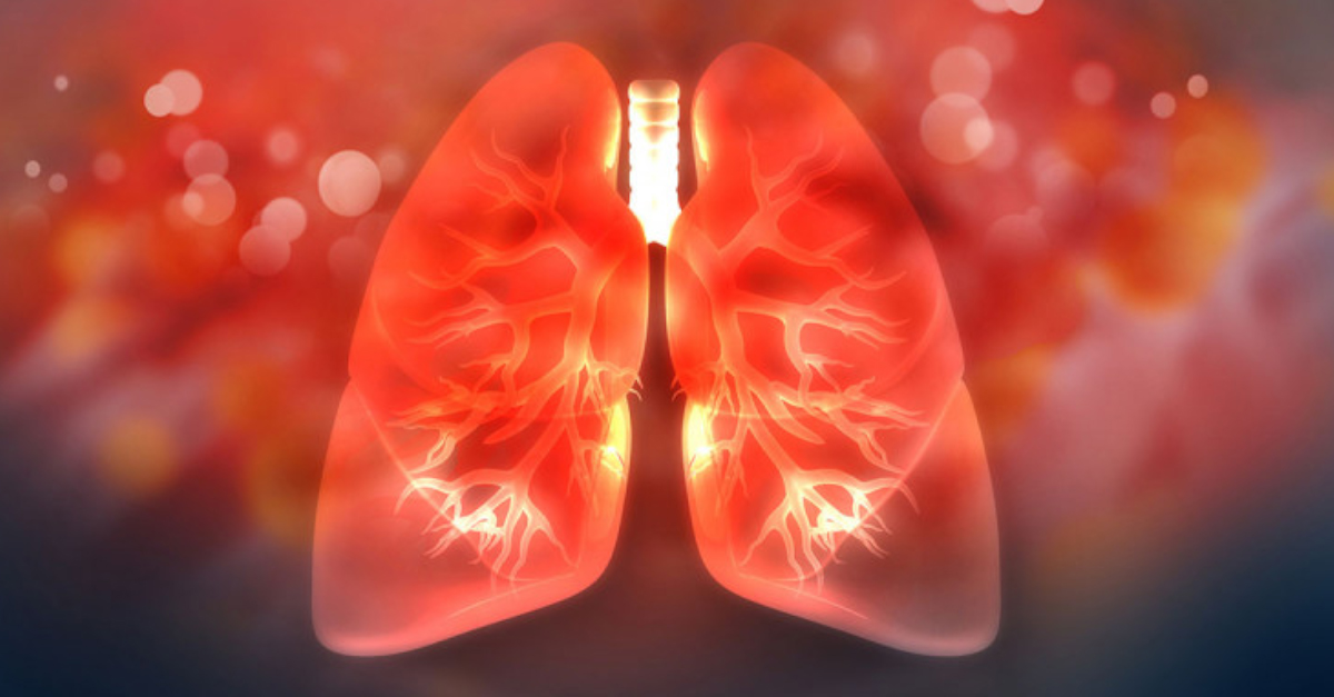 Medscape's tweet photo. .@NarjustFlorezMD reflects on the significant changes in the treatment landscape of early-stage non-small cell lung cancer in recent years. #NCSLC #OncTwitter https://t.co/4CKcxaPDhb https://t.co/QGa7uI90O6