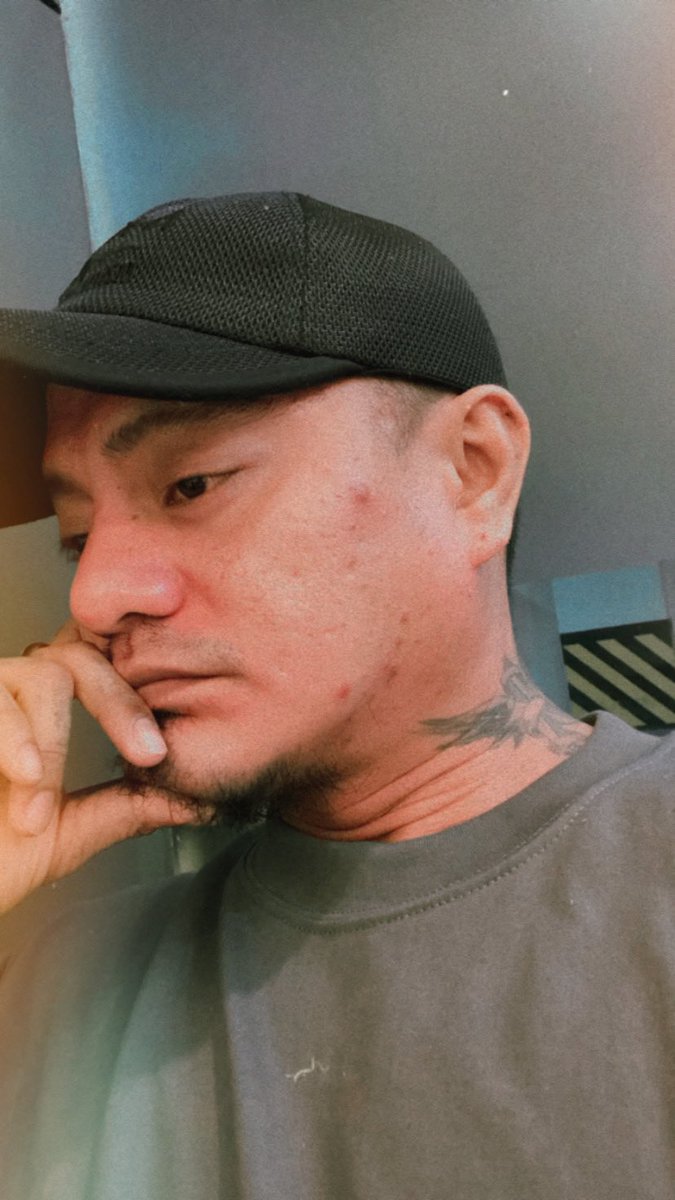 LPalambiano's tweet image. January Break Out 🥹🥹🥹
Taon taon na lang eh eh!

#PimpleProblems #Breakout