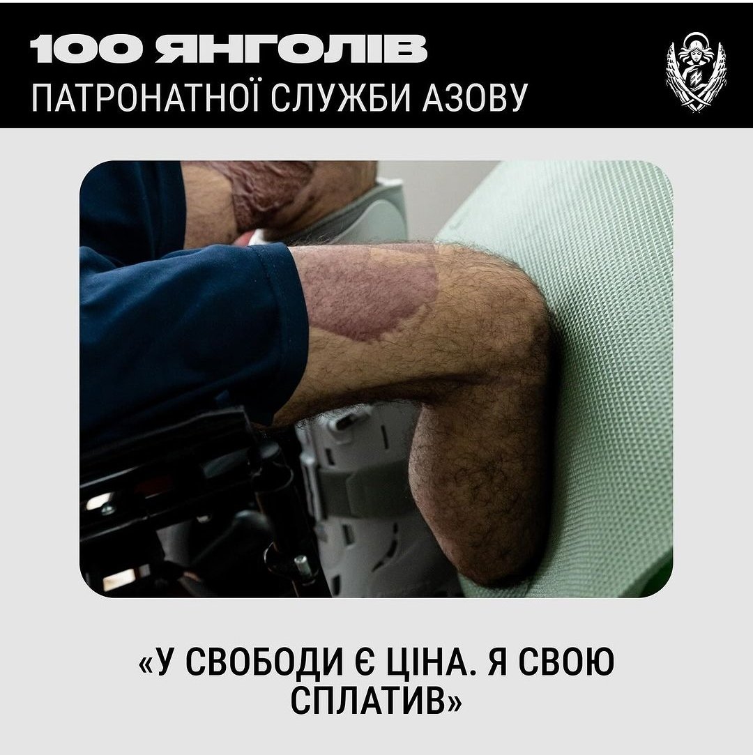 mixaylik's tweet photo. Щонайменше чим я можу віддячити нашим мужнім воїнам — це посприяти їхньому відновленню. Давайте зробимо це разом! Наш внесок забезпечить реабілітацію захисників, які отримали бойове поранення голови, верхніх/нижніх кінцівок, живота, ампутації, опіки та інше https://t.co/JVRWaEY05w