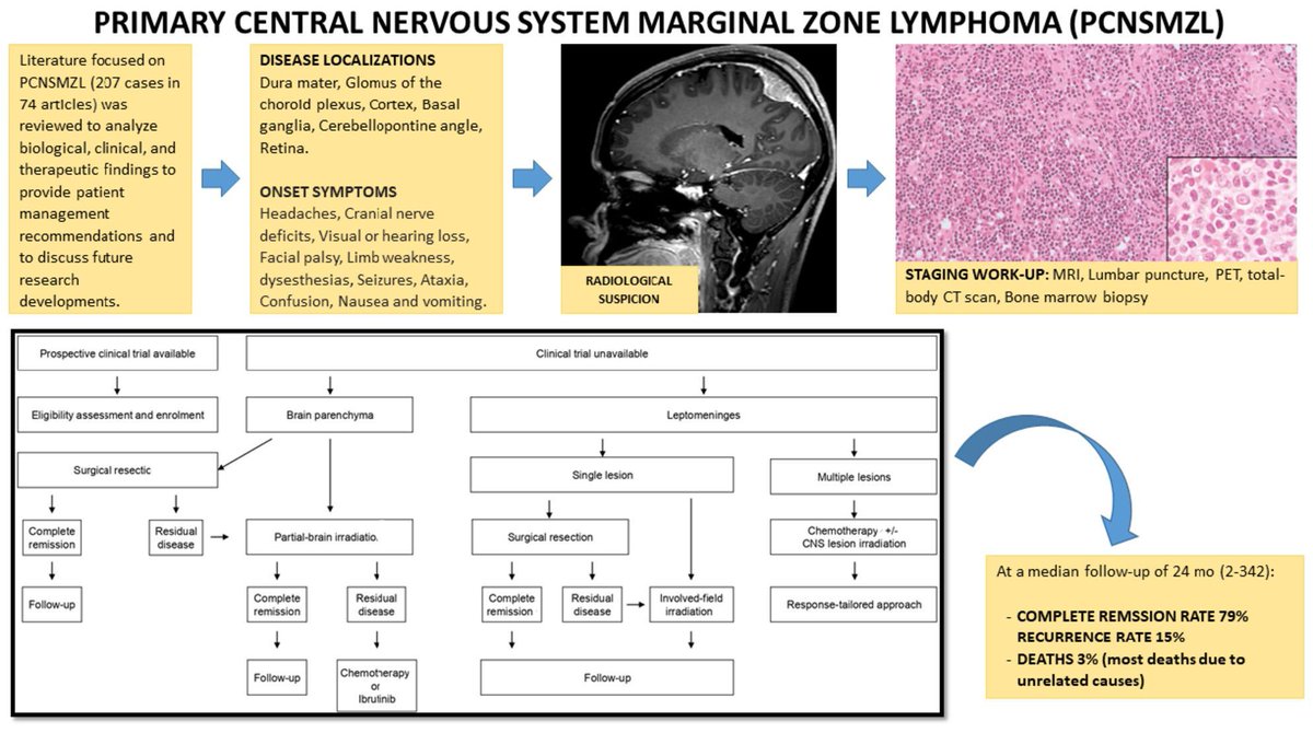 Involuting Marginal Zone Marginal Zone Lymphoma Diagram
