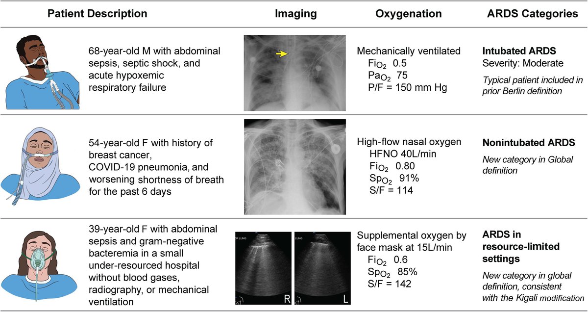 An expansion of the 2012 Berlin definition of ARDS? Yes please! Check out the proposed changes in @ATSBlueEditor, hot off the presses for 2024! buff.ly/4aNiFHN