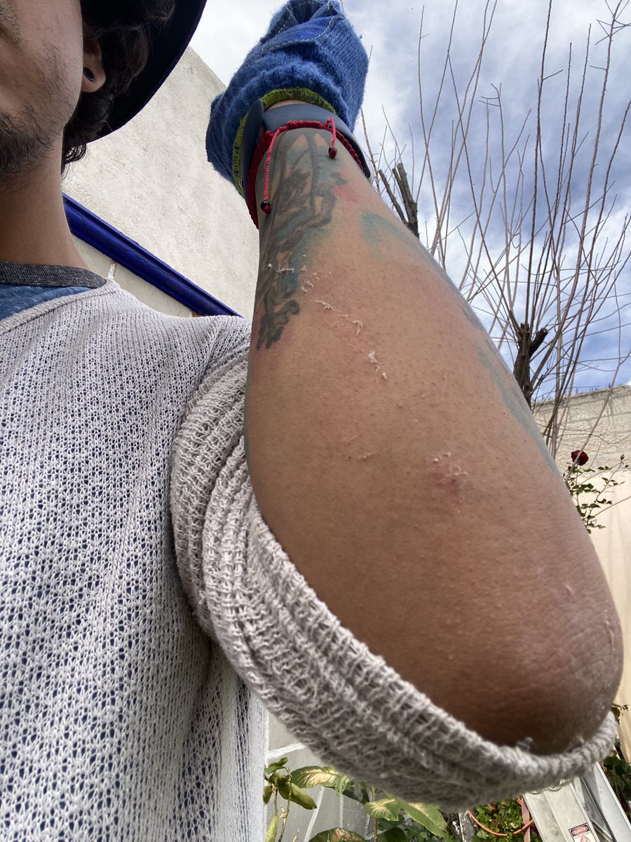 SorRaymundo's tweet photo. Iniciando el año salado. Estuve enfermo los primeros días, hoy casi caigo de la barda al resbalar la escalera 🪜, quedé suspendido por varios minutos jajaja la única que salió a mi rescate fue #Cleta mi gata que subió en chinga. Todo x quitar las luces del árbol 🌲 https://t.co/WzKK7UJb2H