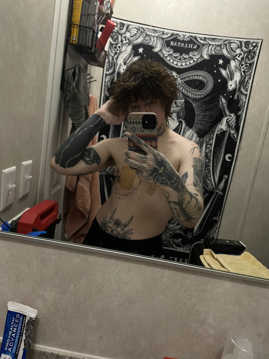 expiredemo's tweet photo. top surgery <3 https://t.co/g45mexunOy