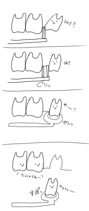 親知らずの治療内容こんな感じでした_(:3 」∠)_ 