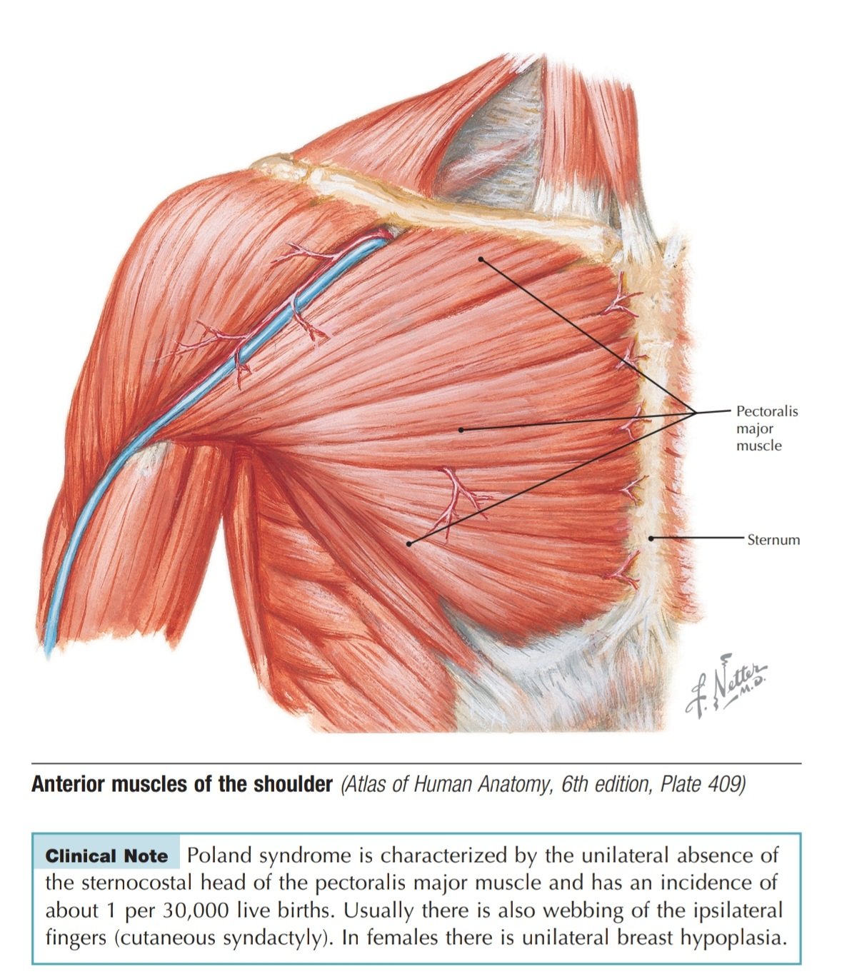 Dr. OMID BANDARCHI on X: Anterior shoulder muscles, also called the pectoral  muscles, attach the upper extremity to the clavicle and the thoracic cage.  These muscles include the pectoralis major, pectoralis minor