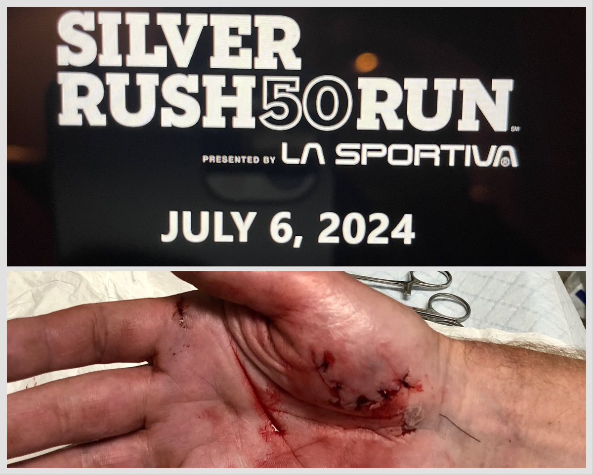 MyLeadFeet's tweet photo. The race where I learned to break a fall with my hands instead of my face. Gotta go back. @LTRaceSeries #SR50 https://t.co/06bgBs4pW3