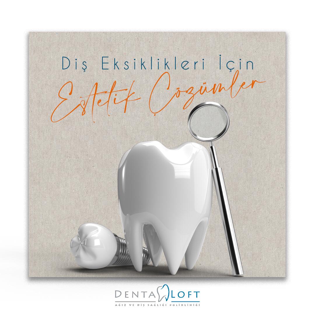 Diş Eksiklikleri İçin Estetik Çözümler

Detaylı Bilgi ve Randevu için:
☎️ 0212 555 5638
💻 dentaloft.com.tr
📍Talatpaşa Cad. No:19/02 Kağıthane/İSTANBUL

#dişhekimliği #dentaloft #gülüş
#diş #dişkliniği #dişsağlığı #ağızvedişsağlığı