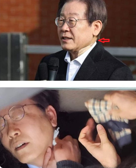 대박! 상처의 위치가 달라! ㅋㅋ