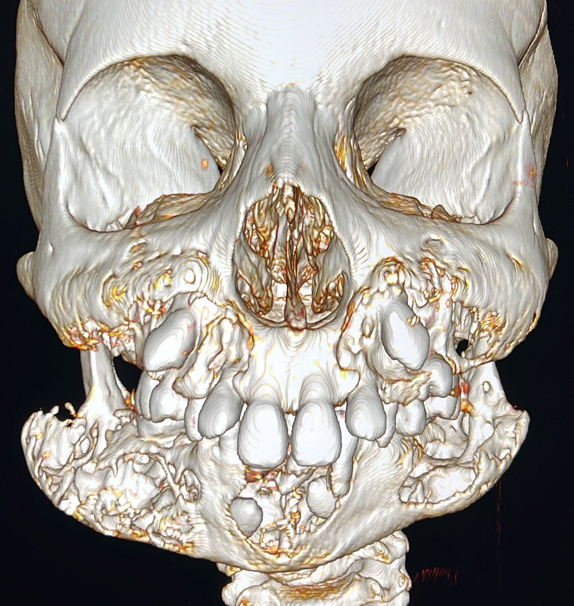 #Radres